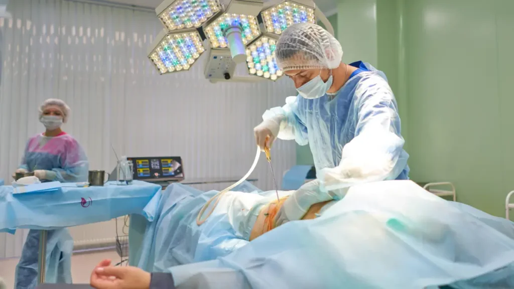 Best Liposuction treatments