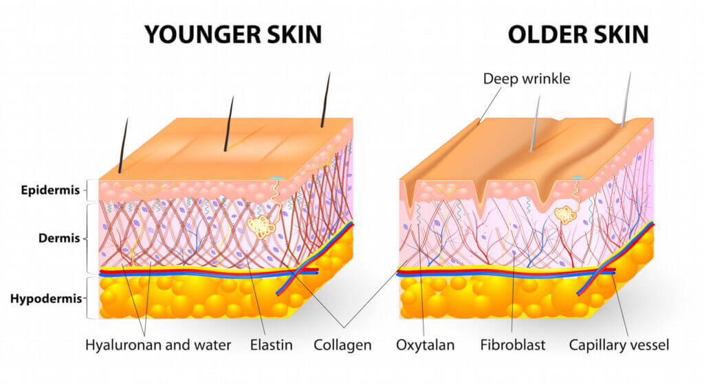 Comparison between the collagen in younger skin and older skin