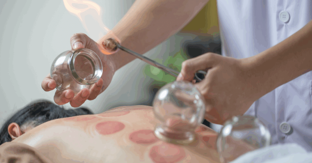 Fire Cupping Traditional Beauty Treatments