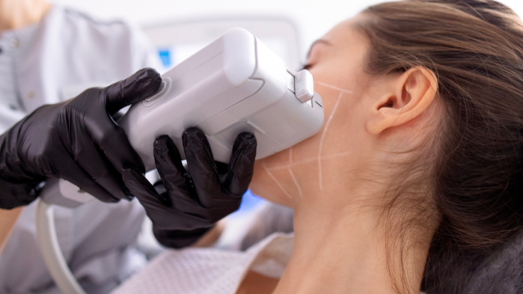 Fiore Aesthetics: Pain-Free HIFU Treatment for Effective Skin Tightening Practitioner performing HIFU skin tightening treatment