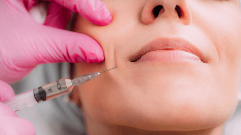 An image of a woman getting fillers to add volume to her face