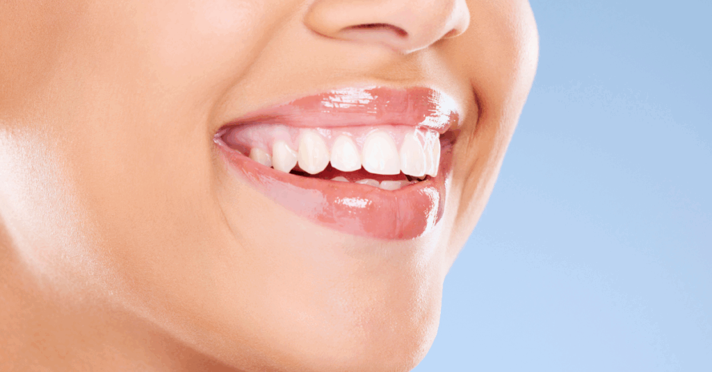 cosmetic dentistry and lip fillers