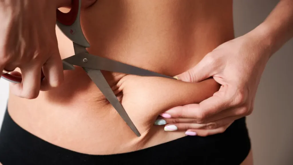Liposuction