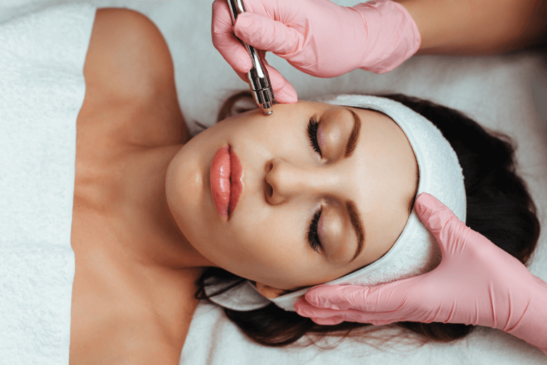 Microdermabrasion is perfect for summer skin