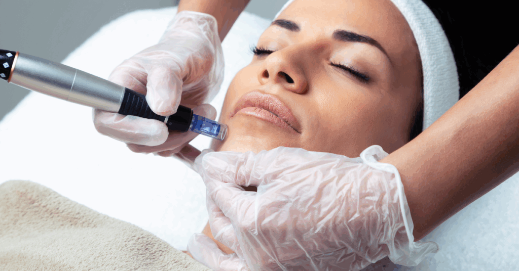 Tweakments are all the rage. Here is an image of a woman getting microneedling as part of her tweakment beauty regime