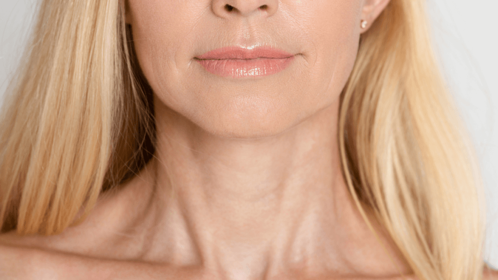 Neck lift lady