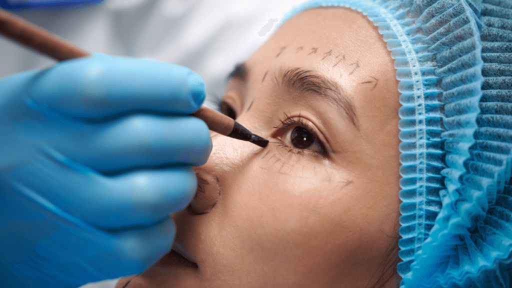 An image of a woman being marked before a facelift surgery