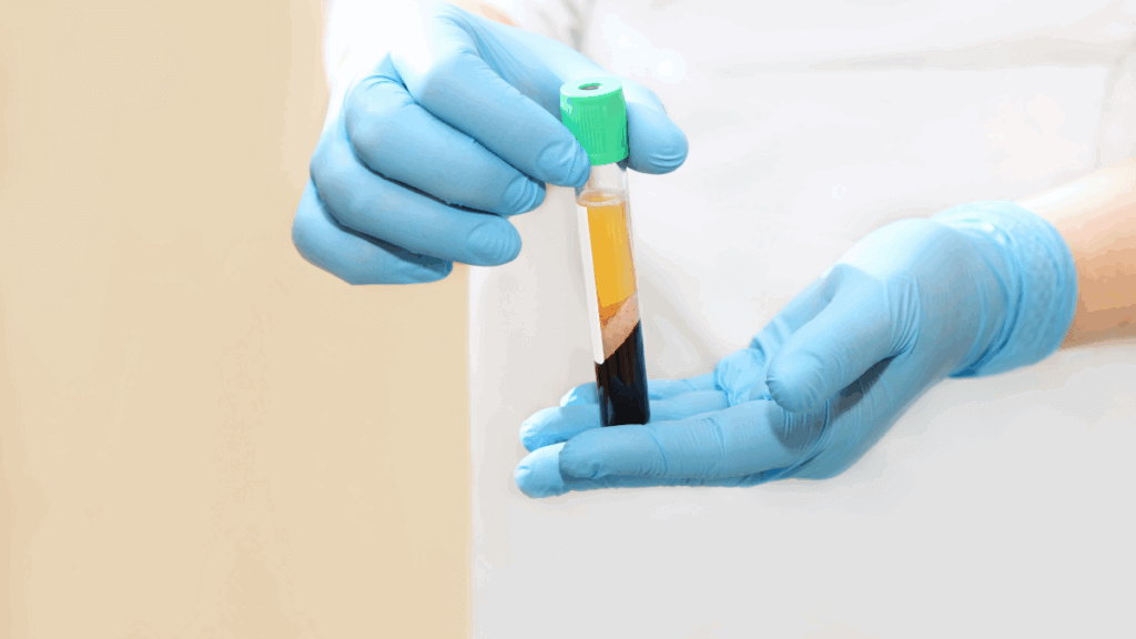 An image of a vile of blood separated into different part for an article about the power of PRP