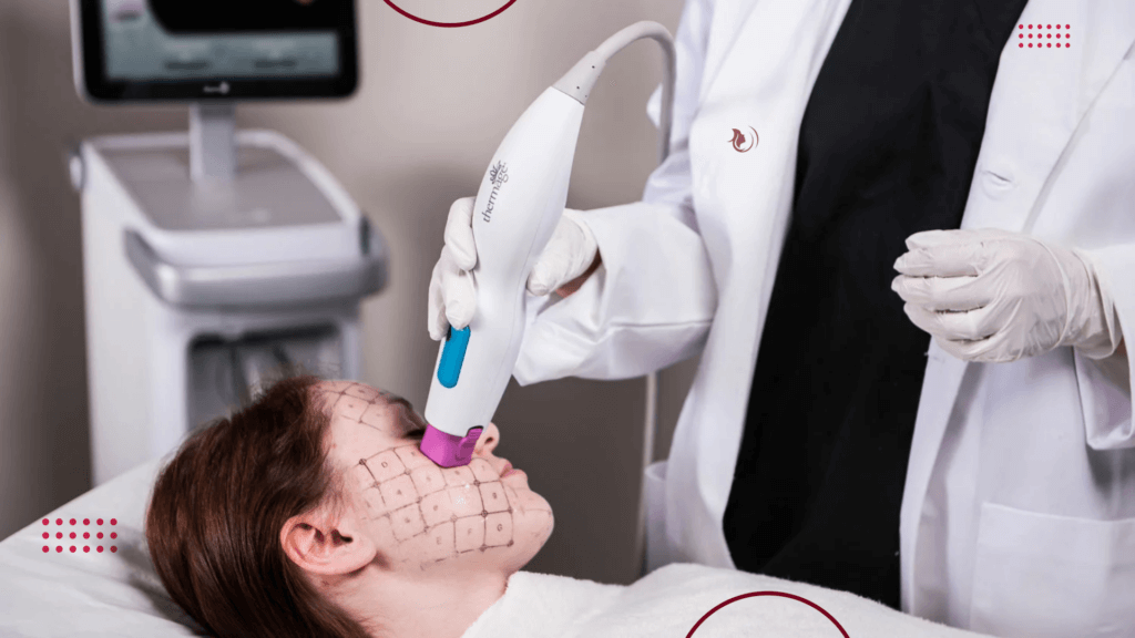 Female patient having Thermage treatment