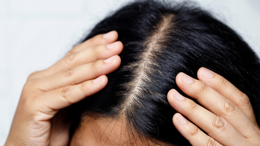 Can Grey Hair Be Reversed?