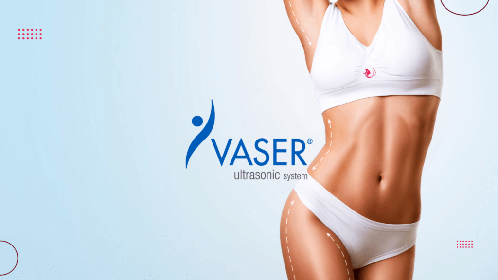Vaser