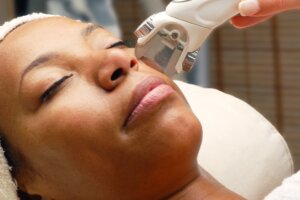 Darker woman getting a laser treatment on face