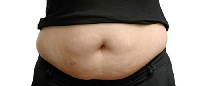 Do People Really Need Liposuction?