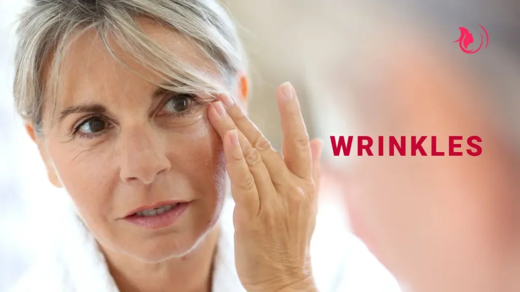 wrinkles